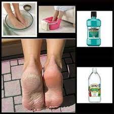 Pin On Pedicure