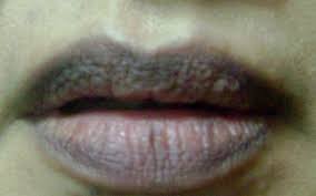 Bibir kering dan hitam tentu merupakan salah satu mimpi buruk yang tidak ingin dialami oleh setiap wanita. 33 Penyebab Bibir Hitam Dan Cara Mengatasinya Halosehat