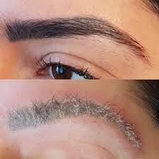 Hopefully this helped, wish you the best of your treatments. Tattoo Removal On Black Asian Skin Lorena Oberg