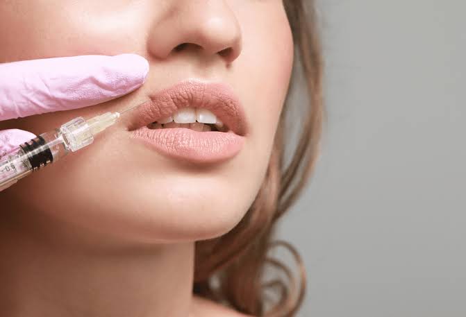5 facts about lip fillers
