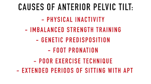 Many hip flexor strengthening exercises can be done at the gym, though they can also be done at home. Fix Anterior Pelvic Tilt In 10 Minutes Per Day With This Corrective Routine