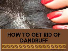 Neem oil is best used diluted, since the pure oil can damage your scalp. How To Get Rid Of Dandruff Home Remedies To Cure Dandruff Permanently Zaineey S Blog