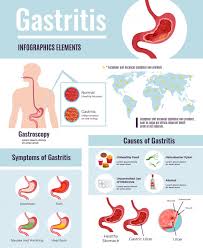 If your stomach ulcer is caused by an h. Free Vector Gastritis Symptoms Stomach Ulcer Causes Information On Unhealthy Food Habits World Population Affected Infographic Poster