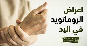 اعراض الروماتويد في اليد Hands Thumbs Up Holding Hands
