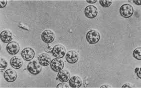 Image result for Stool Leukocytes