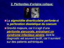 Afectiuni carora trebuie sa li se acorde o deosebita atentie Ppt Peritonites Powerpoint Presentation Free Download Id 257785