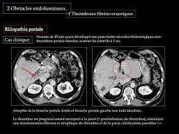 Ppt Les Clefs Du Systeme Porte Powerpoint Presentation Free Download Id 1313393