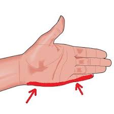 sol el parmaklarinda uyusma ve karincalanma