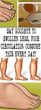 Say Goodbye To Swollen Legs Poor Circulation Consume This Every Day Poor Circulation Swollen Legs Leg Circulation Remedies