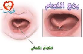 إِنَّ الْإِنسَانَ لَفِي خُسْرٍ (2) قوله تعالى : ØªØ¹Ø±Ù Ø¹Ù„ÙŠ Ø£Ù…Ø±Ø§Ø¶Ùƒ Ù…Ù† Ù„Ø³Ø§Ù†Ùƒ