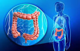 Cáncer de colon, importancia de la detección precoz - Colonoscopias Córdoba
