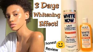 By rebecca o'dell published in d magazine july 1987 sms. White Now Honest Review 3 Days Whitening Lotion Howto Whitenow 3dayswhitening Halfcastlotion Youtube