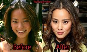 What has Jamie Chung had done? : r/Vindicta