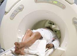 Study Ct Scans Increase Risk Of Brain Cancer The Whistler Nigeria
