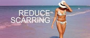 This isnt easy for me to share but i do so with purpose and for those who are unaware and dont know what they will encounter if they get the gastric sleeve a. Gastric Sleeve Scars Guide To Reduce Scarring Quickly