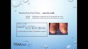 Podiatry Billing Coding For Success Youtube