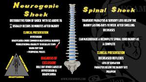 Image result for Spinal Shock