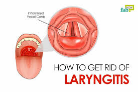 How To Get Rid Of Laryngitis Remedies For Instant Relief Home Remedies For Laryngitis Remedy For Lost Voice Cure For Laryngitis