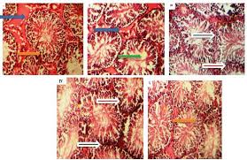 Image result for Rhaphiostylis beninensis