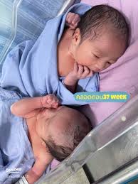 รีวิวน้องแฝดความน่ารัก สายฟ้าแลบ 👶🏼💕