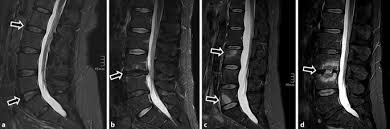 These routers are made by vendors including cisco, extreme, huawei, juniper, and nokia, and use the. When An Incidental Mri Finding Becomes A Clinical Issue Springerlink