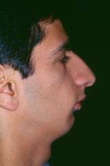 Cirugía Plástica Súper Especializada