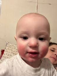 Jedediah Levi Burch, 6 months, of Miles City.