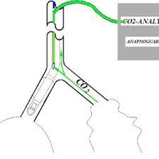 The traffic light on this equipment clearly indicates the co2 concentration the co2 detection column can be placed on a table or mounted on a square less than 2m from the ground. Pdf Detection Of Endobronchial Intubation By Monitoring The Co2 Level Above The Endotracheal Cuff