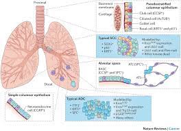 Ca 27.29 and anything higher than that then it could indicate cancer. Which Is The Most Widely Used Tumor Markers For Early Detection
