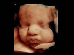 Expressions Ultrasounds Abilene, Texas