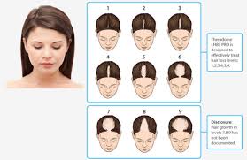 Essential elements has put together a great combination of both herbal ingredients, like saw palmetto, biotin, and bamboo stem; Leading Hair Loss Treatment Specialist In Mumbai Women S Hair Loss Treatment In Mumbai