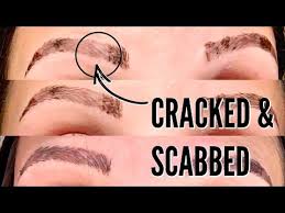 Microblading Healing Process The First 2 Weeks Youtube