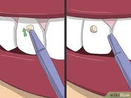 Sonjalaurenbookings@gmail.com ♡ keep up with me. How To Apply Tooth Gems 14 Steps With Pictures Wikihow