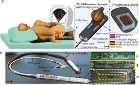 Here are 10 more facts about prostate cancer. Simultaneous Transrectal Ultrasound And Photoacoustic Human Prostate Imaging Science Translational Medicine