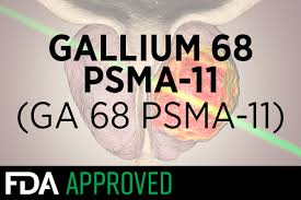 They use these risk levels to help them develop treatment plans. Fda Oks Game Changer Radiotracer For Prostate Cancer Medpage Today