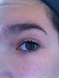 For some people, results of surgery may last a lifetime. How To Get Rid Of An Extra Eyelid Crease Beautylish