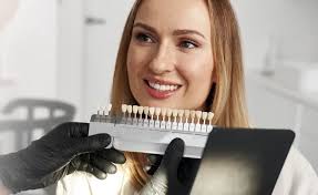 Dental Veneers in Naperville, IL