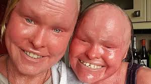 Young Essex cancer patient diagnosed at 12 asked parents 'am I going to  die?'