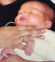 Georgina Chaska Malone Is Going the Distance for Smile Train