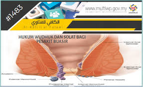 Hilangnya cairan ini kemudian oralit akan menggantikan cairan dan elektrolit yang keluar dari tubuh. Pejabat Mufti Wilayah Persekutuan Al Kafi 1483 Hukum Wudhuk Dan Solat Bagi Pesakit Buasir