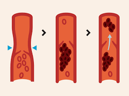 May 28, 2020 · what foods should you avoid when taking apixaban? Apixaban Side Effects Dosage Uses And More