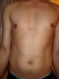 Boasting a massive 25 joules of power, this is one of the most powerful at home ipl devices on the market. Review Viss Beauty Ipl Hair Removal System Unfinished Man