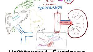 Platypnea Orthodeoxia Syndrome Youtube
