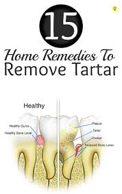 15 Amazing Home Remedies To Remove Tartar Brushing Teeth Every Day Proper Flossing Oral Hygiene Regular Dental Teeth Health Oral Health Care Home Remedies
