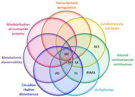 Cardiac Symptom Overlaps Between Huntington S Disease And Other Neuro Cardio Diseases Symptoms Huntington Disease Spinal Muscular Atrophy Parkinson S Disease