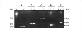 Specific Pcr For Amplification Of Nif Genes From Azospirillum Download Scientific Diagram