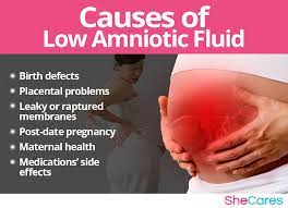 Low Amniotic Fluid | Shecares
