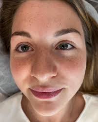 Tracy Swain (@trace.aesthetics) • Instagram photos and videos