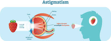 Image result for Presbyopia