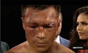 Francisco “Bandido” Vargas arrastra un grave problema con los cortes